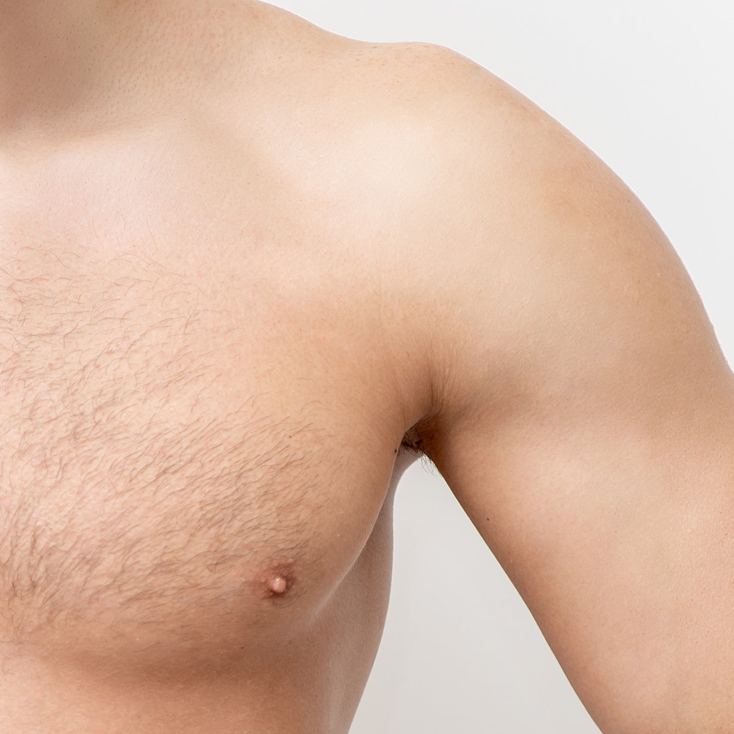Laser Hair Removal